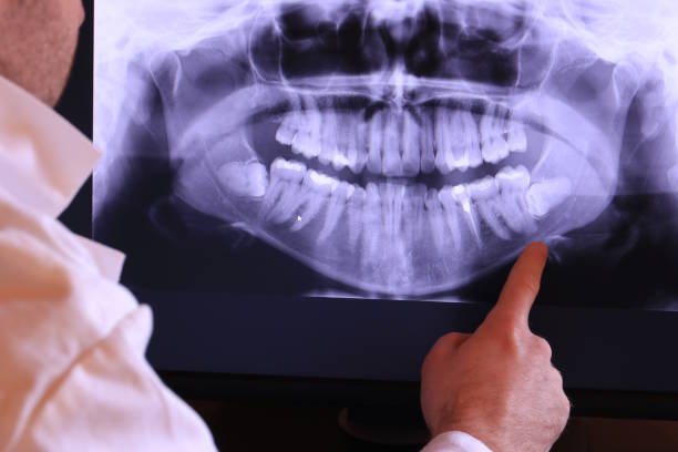 Best Pediatric Emergency Dentist in Martinsville, VA