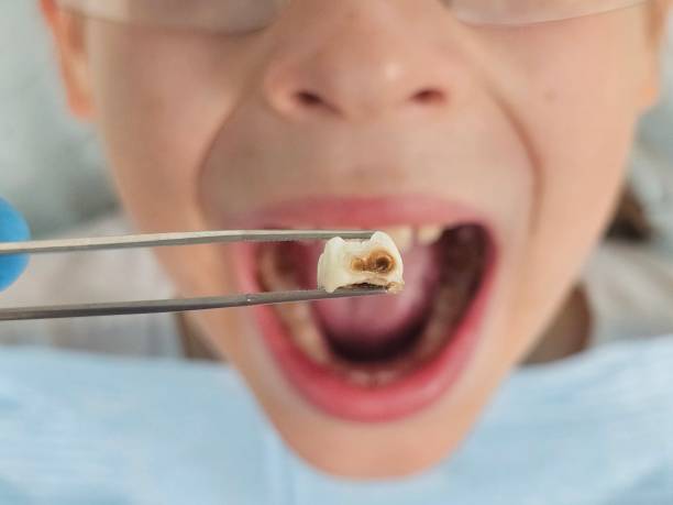 Best 24-Hour Emergency Dentist in Martinsville, VA